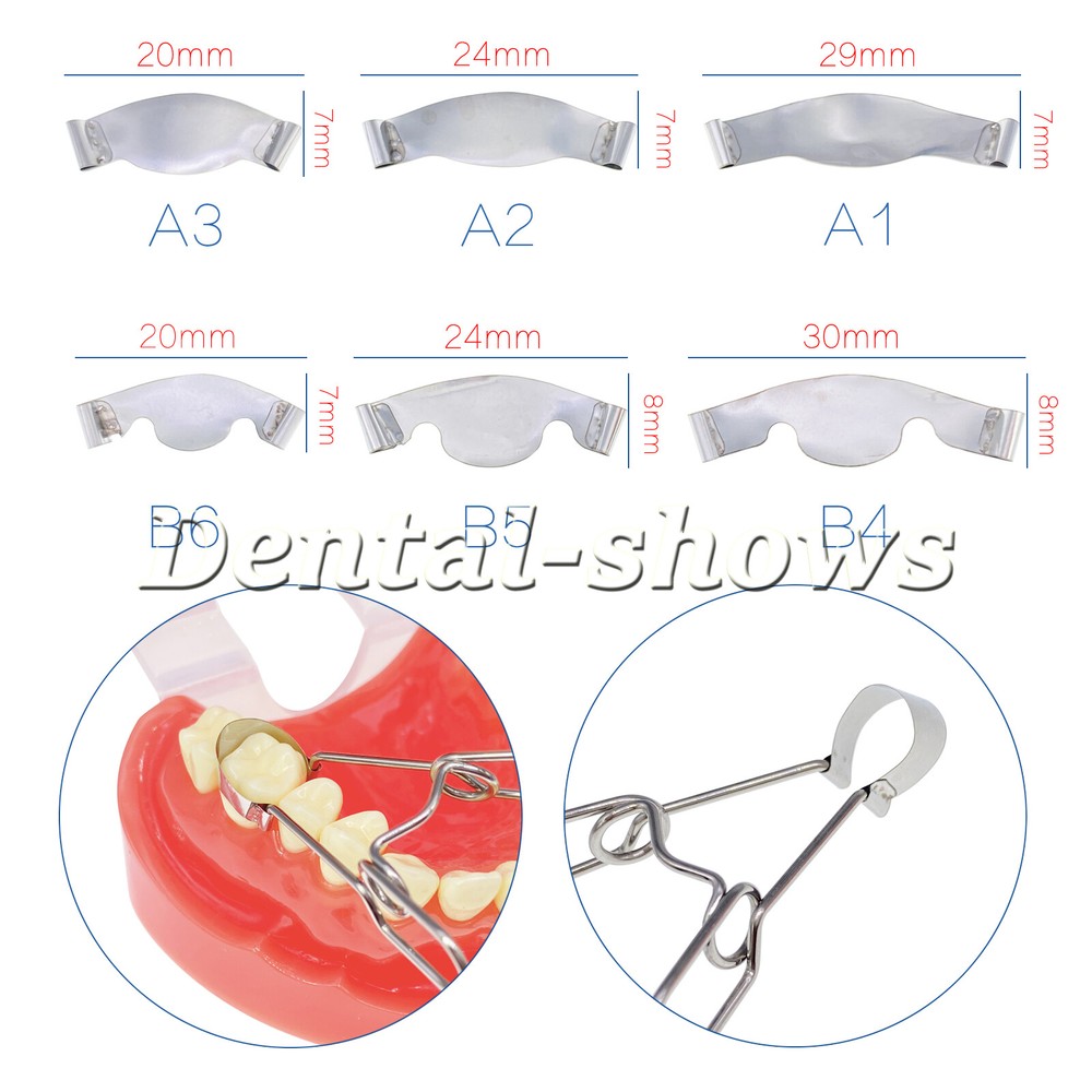 Dental Saddle Contoured Metal Matrices Matrix Band / Springclip