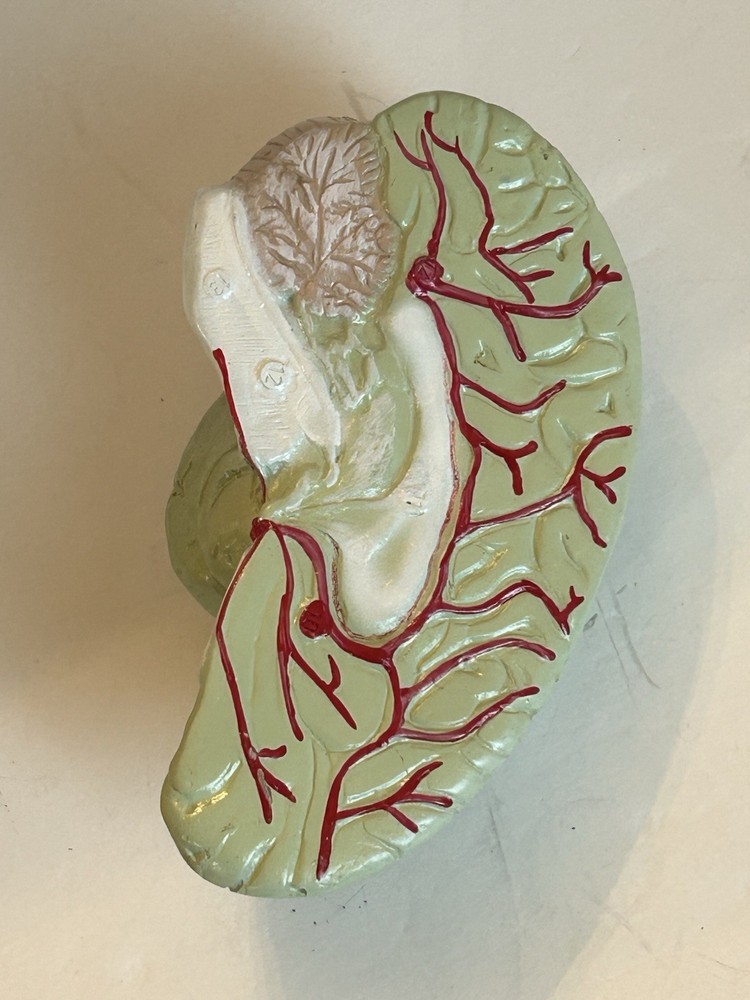 Bobbitt Laboratories Anatomical Half Head Model Removable Brain Vintage