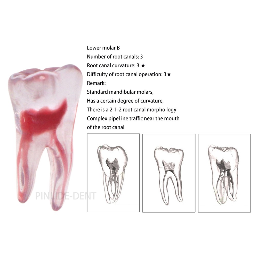 Dental Resin Root Canal Teeth Model Endo Practice Block RCT Pulp Cavity Study