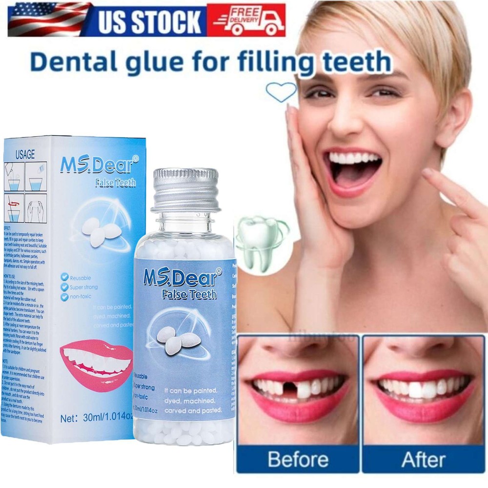 Tooth Repair Granules Temporary Kit Fitting Beads Reusable Moldable False Teeth