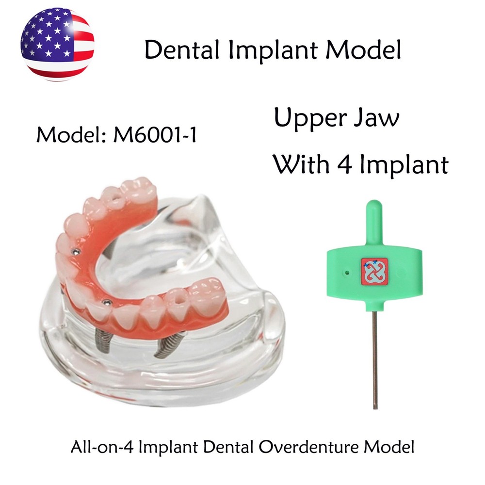 Dental Implant All-on-4 Overdenture Treatment Model Upper/Lower 4 Implants Clear