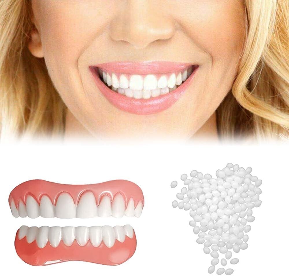 Instant Smile Natural Shade Complete Teeth Makeover Kit, Upper & Lower Veneers