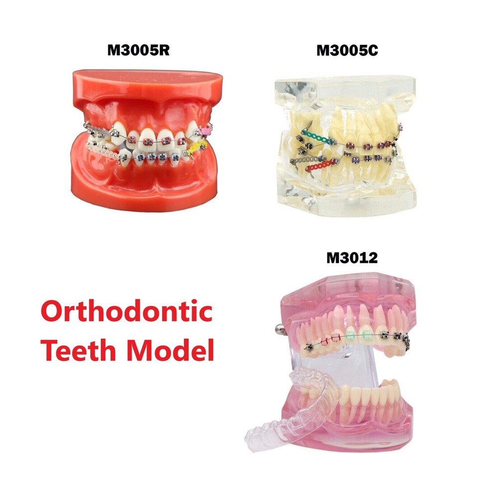 Dental Ortho Teeth Study Model With Metal Ceramic Brackets Arch Wires Ties Chain