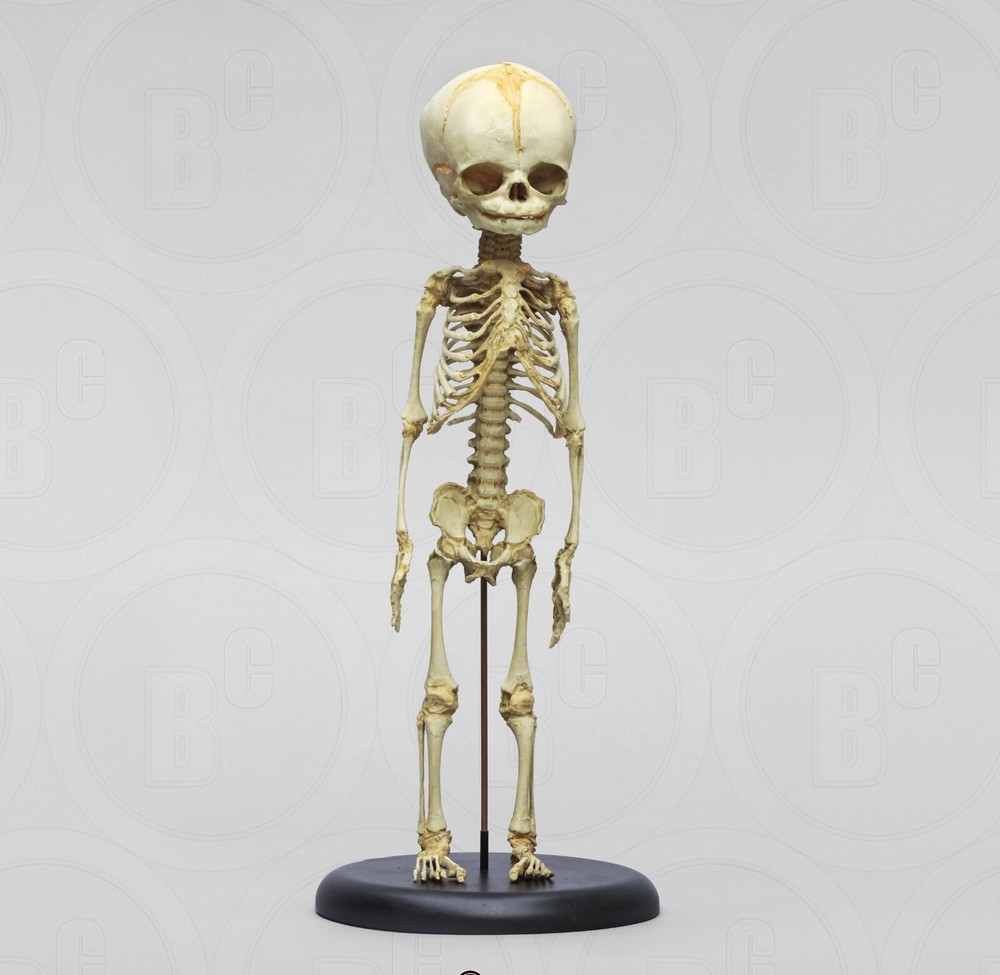Fetus Skeleton Model