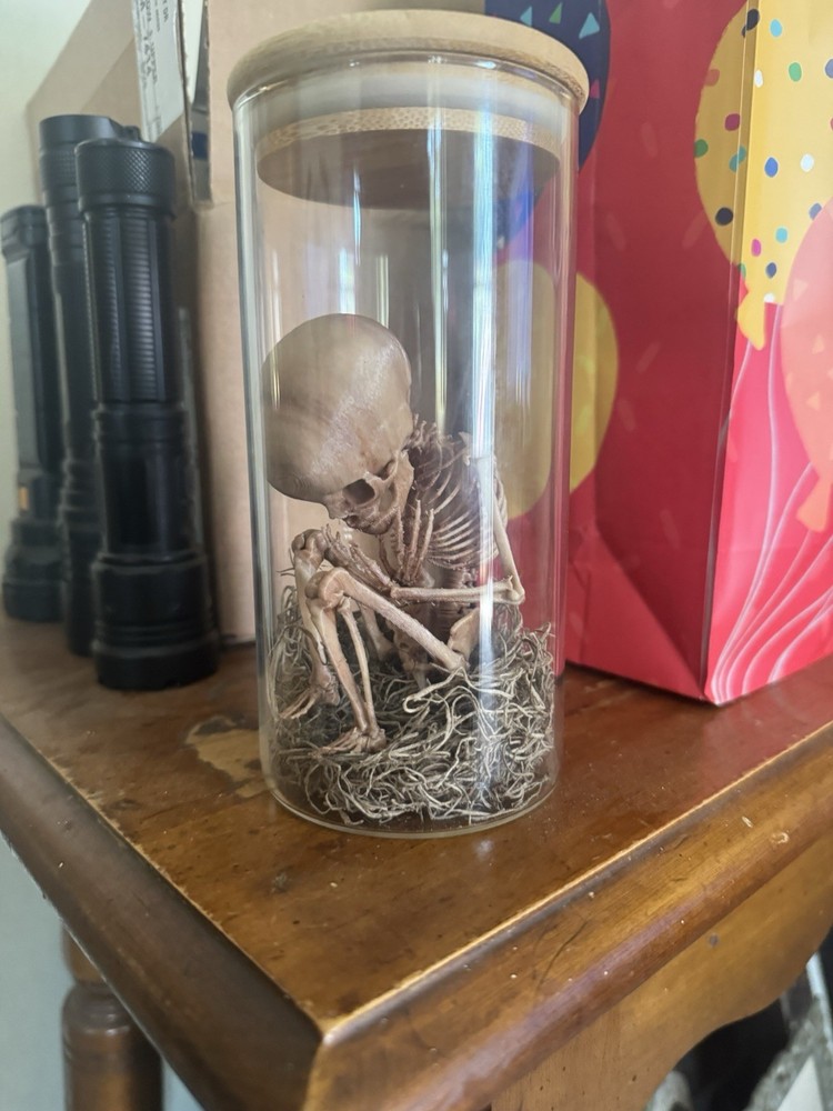 3-D Printed Fetus Skeleton
