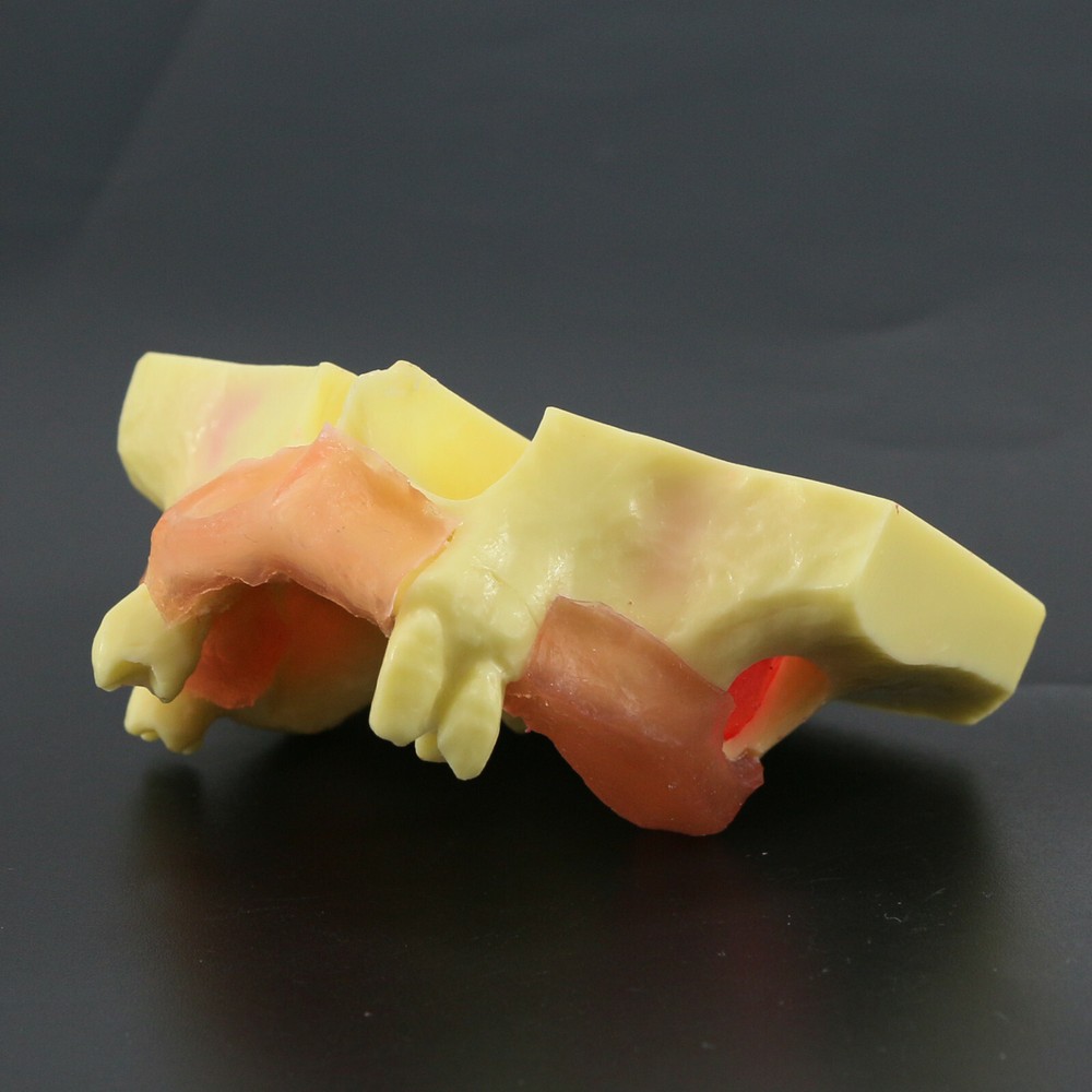 Dental Typodont Teeth Model Sinus Lift Practice Study Teach Demo Model 2012 2013