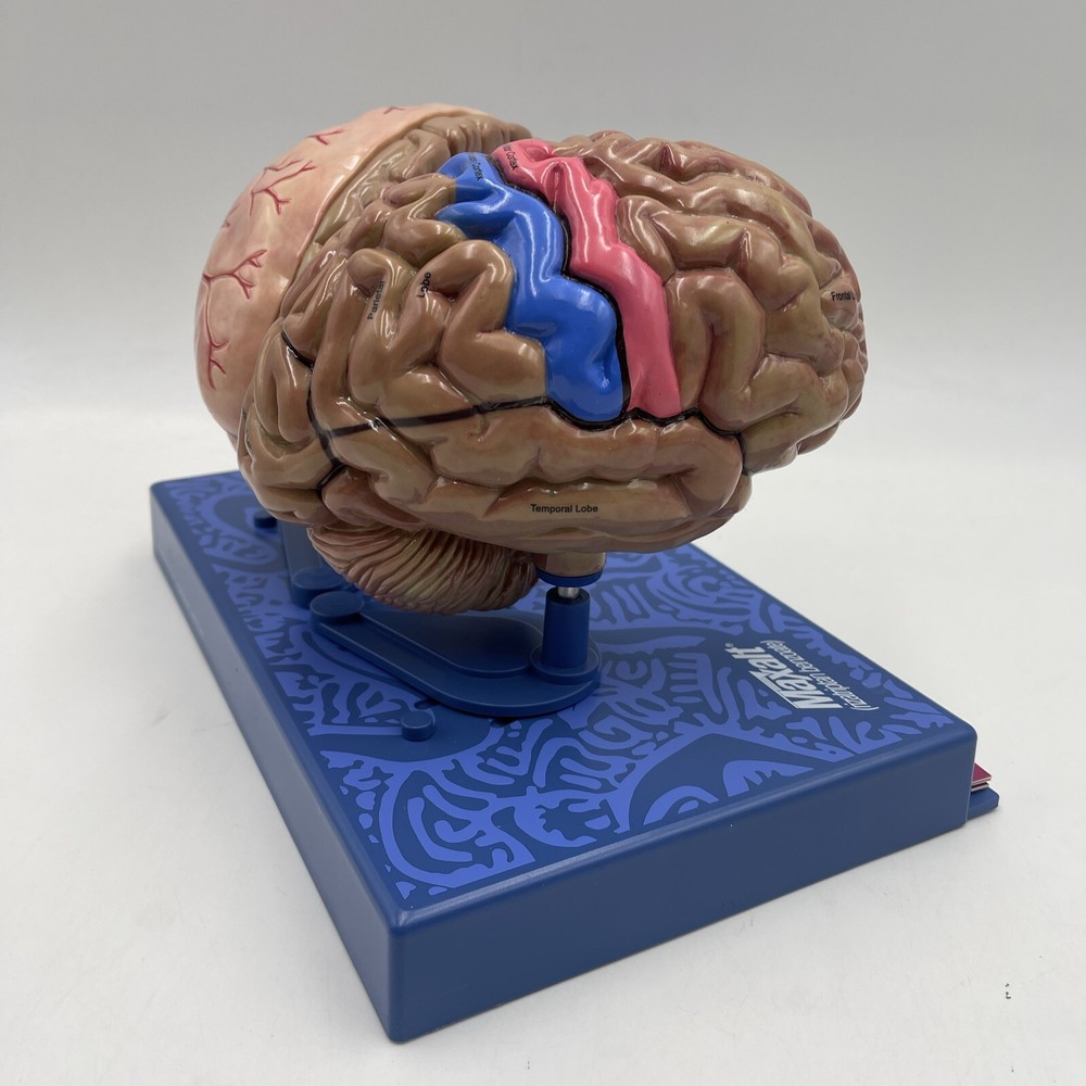 Maxalt Brain Anatomical Model Migraine Pathology Education Teaching Model