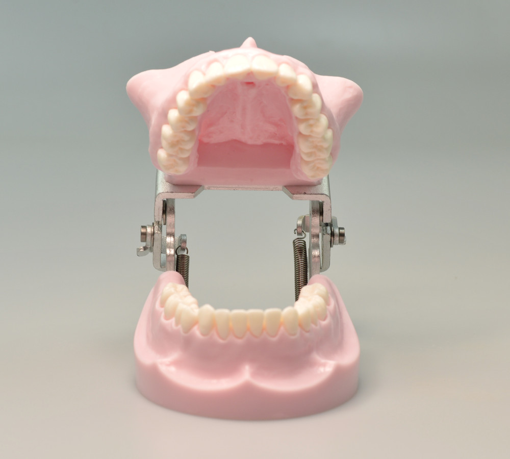 Dental Typodont Orthodontic Model Teeth Anchorage Implant Training Practice
