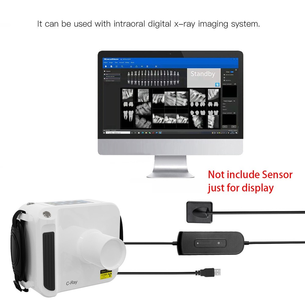Dental X Mobile Rays Digital Machine Rayos Without Shield RX