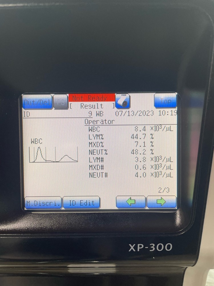 Sysmex XP-300 Automated Hematology Analyzer