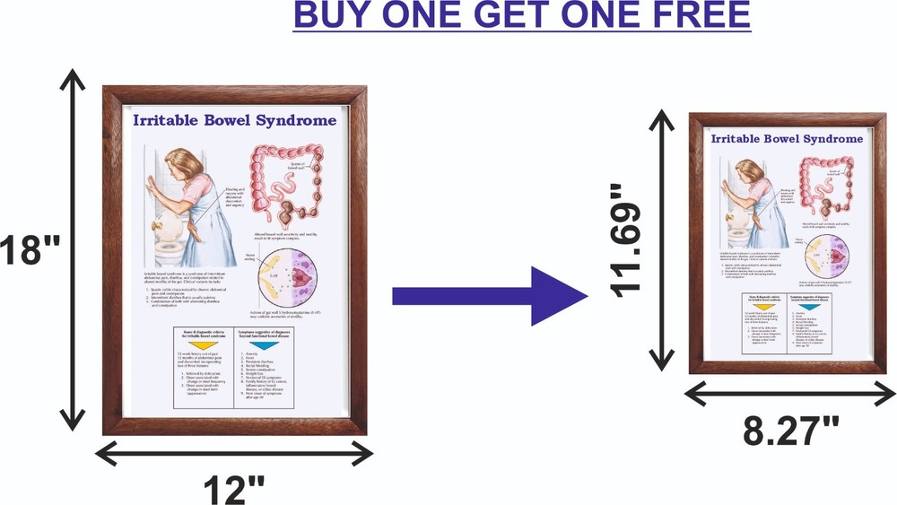 Irritable Bowel Syndrome Chart 12x18 inches