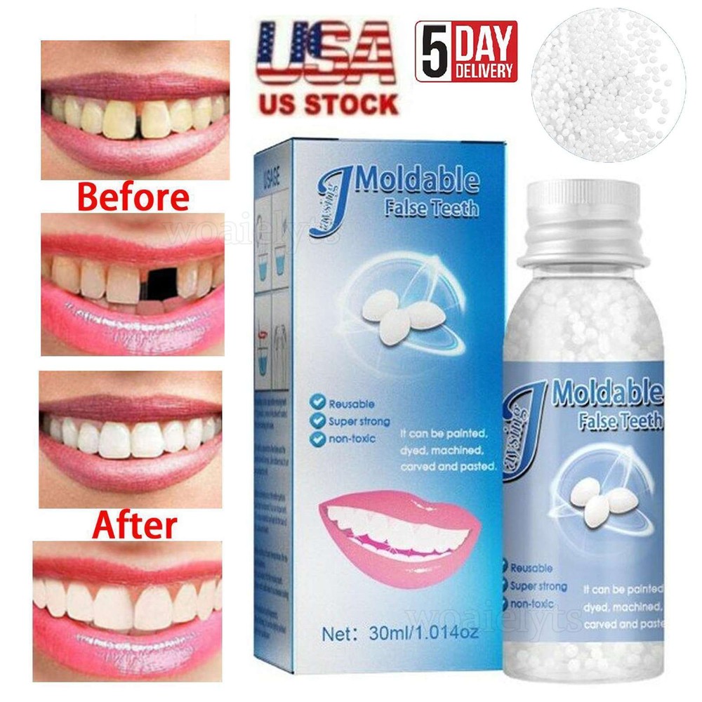 Tooth Repair Kit Temporary Teeth Replacement Beads for Missing & Broken Teeth