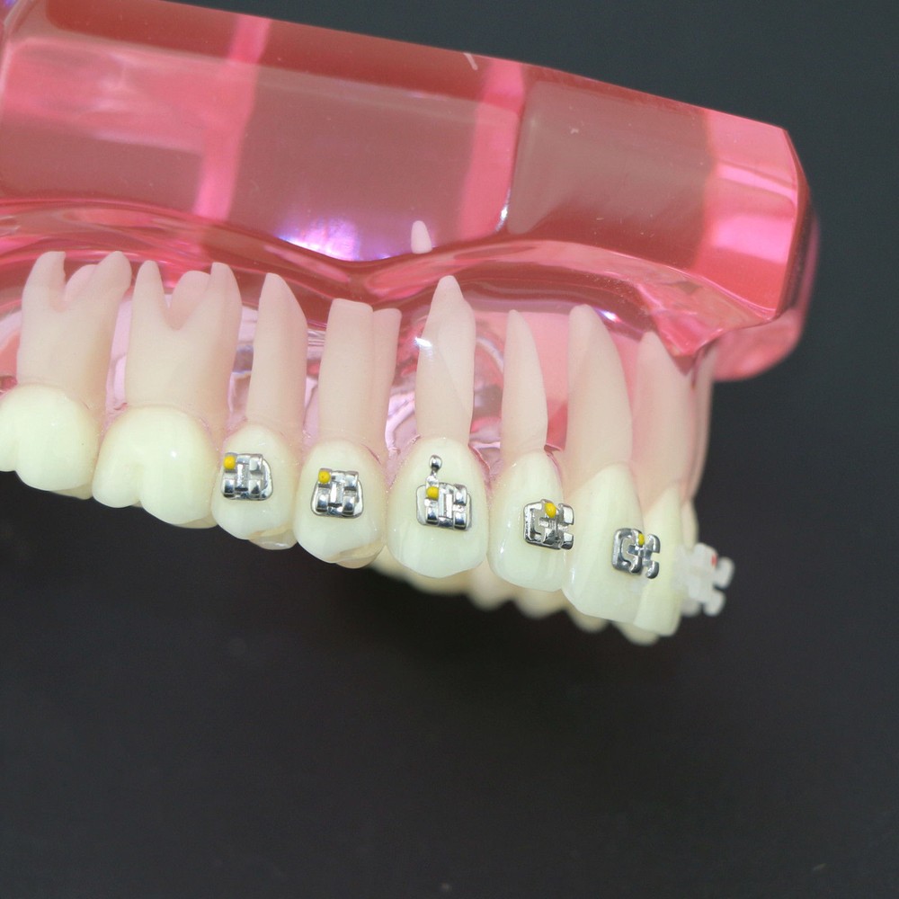 Dental OrthodonticCeramic Brackets 3003 Teeth Study Treatment Model With Metal