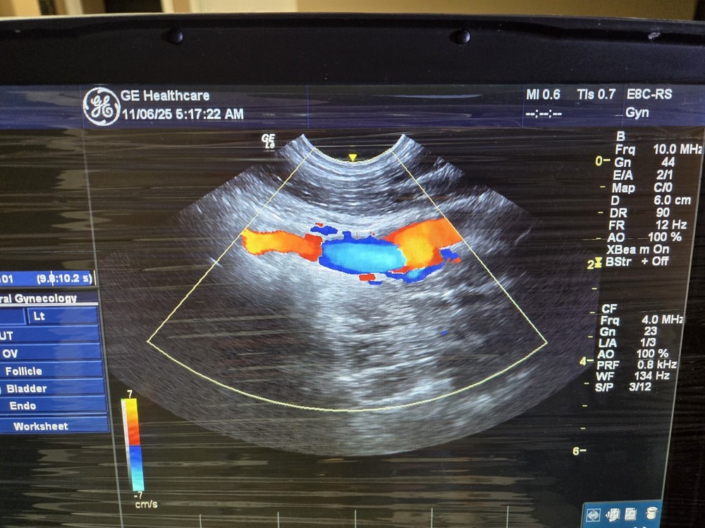 GE E8C-RS Ultrasound Probe / Transducer