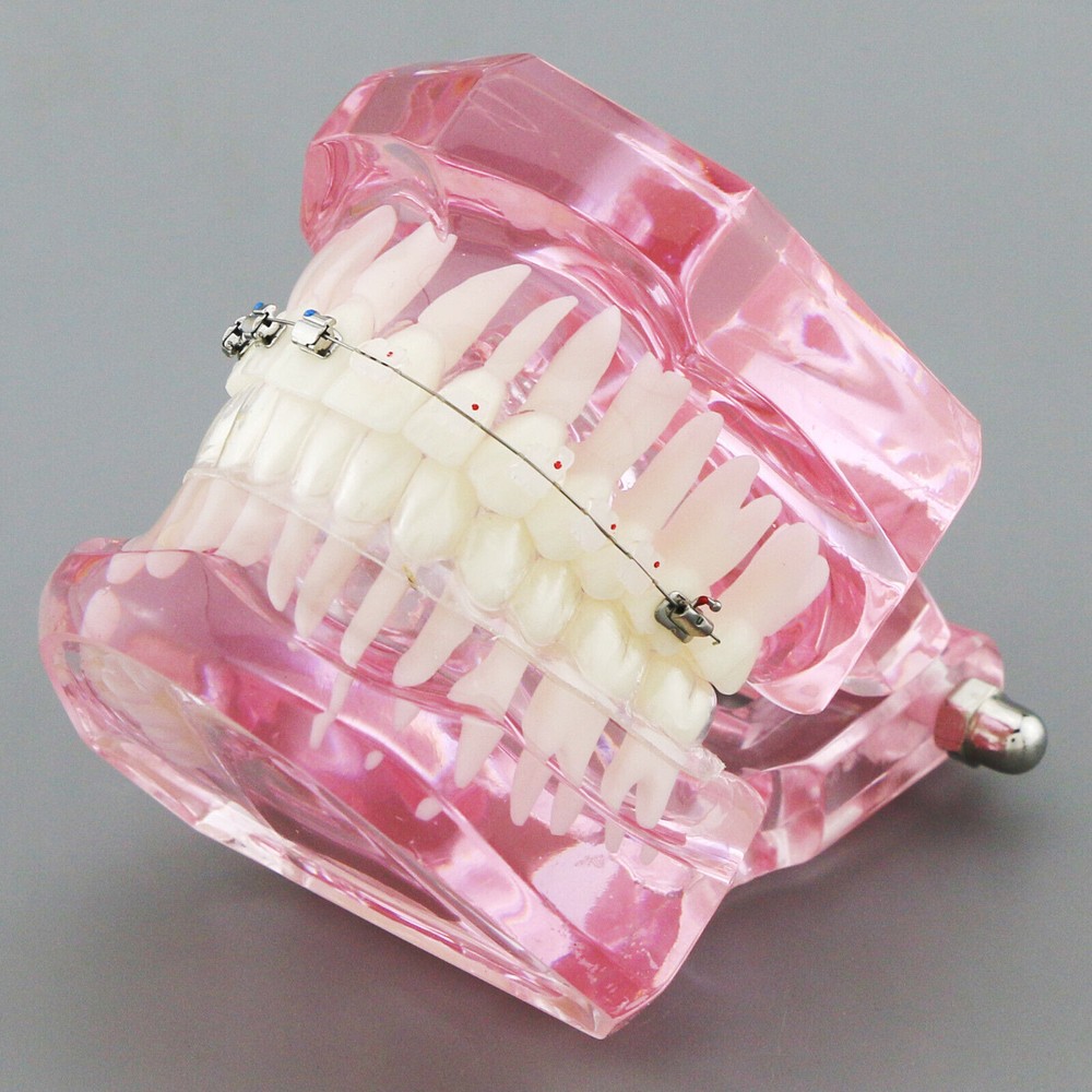 Dental Typodont Model Self-ligating Metal Bracket Ceramic Transparent Retainer
