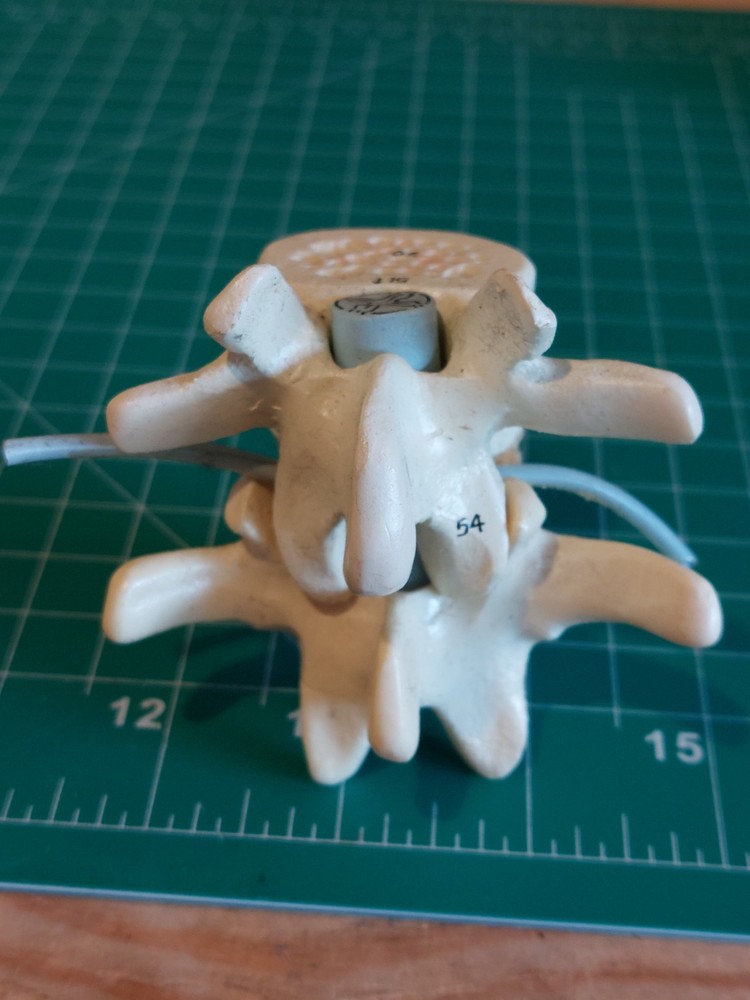 Human Spine Vertebrae Model – Anatomical Teaching Tool – Medical Display