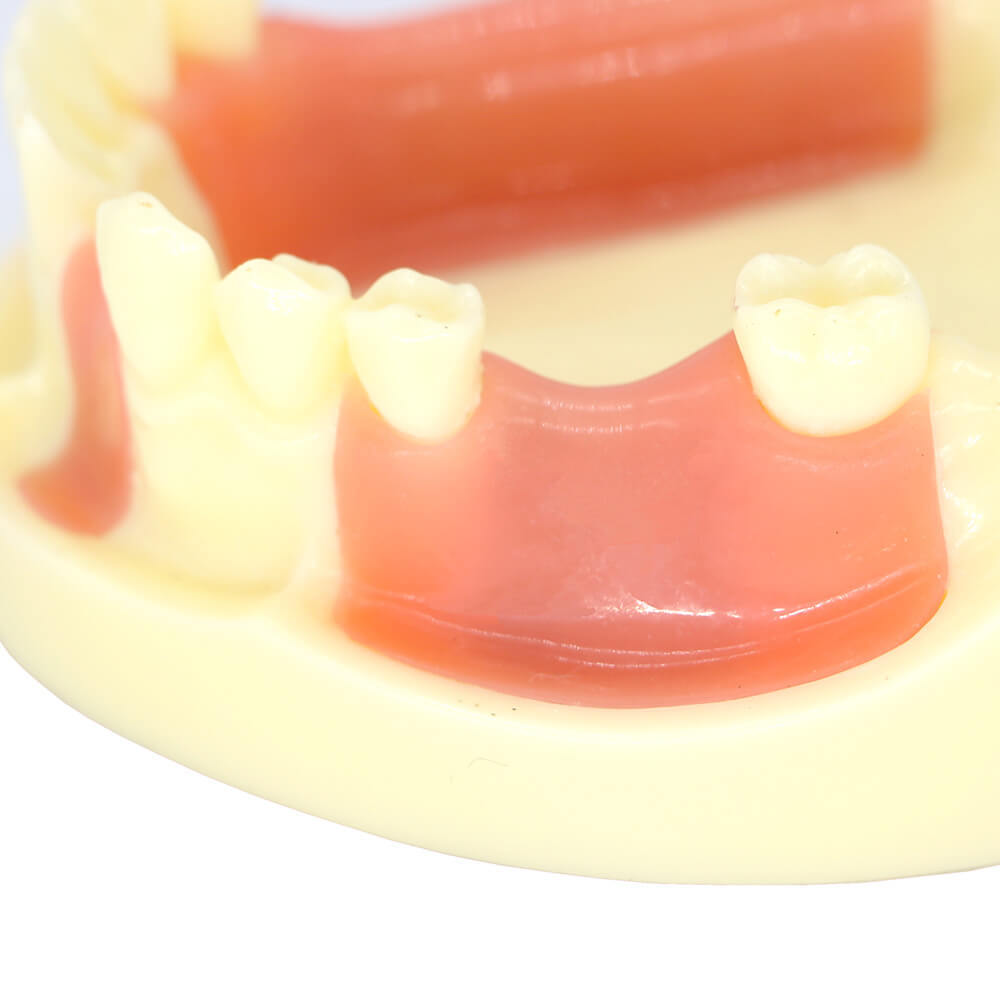 Dental Implant Training Model with Missing Teeth & Bone Loss Simulation
