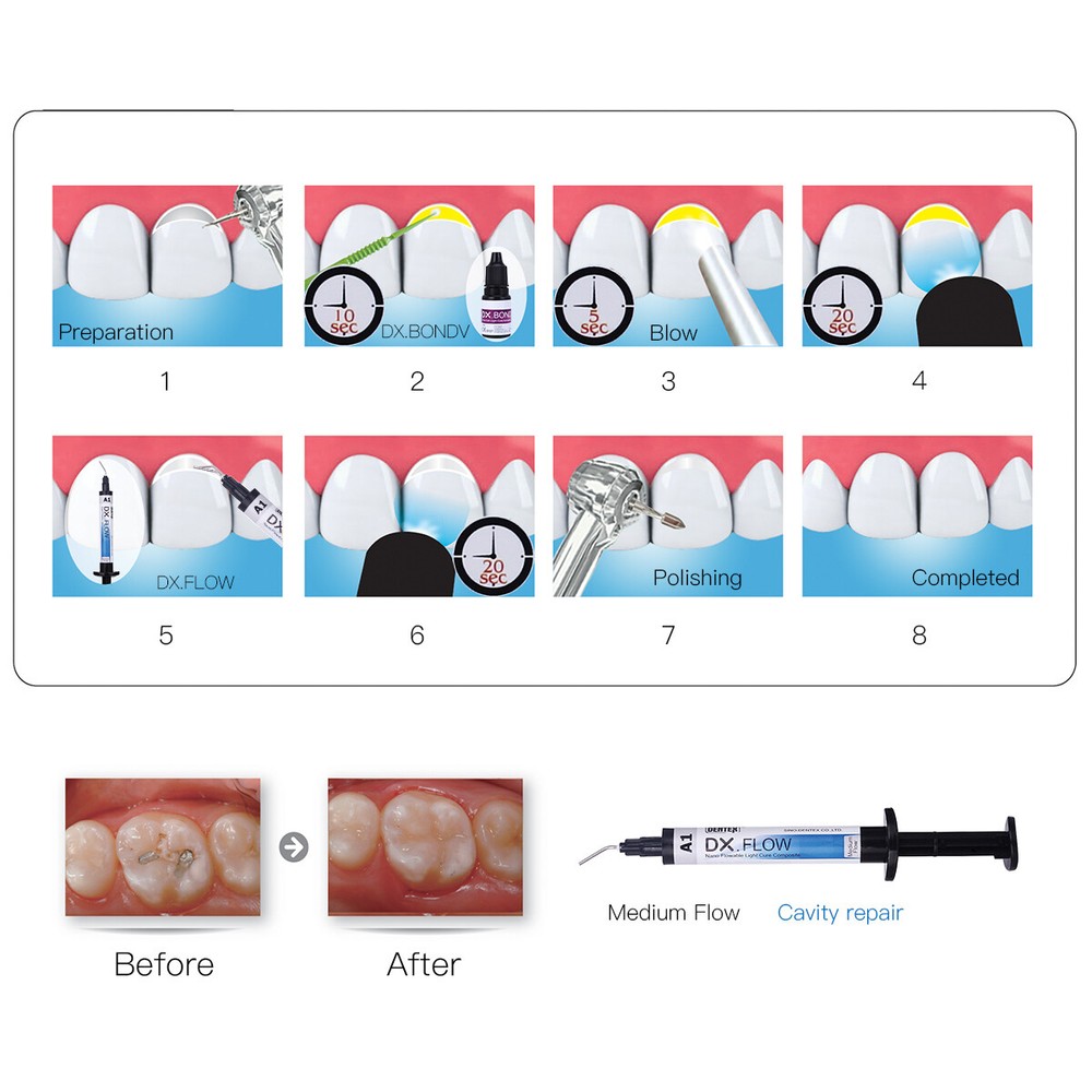3Pcs Dental Dentex Flowable Light Cure Composite Resin Medium Flow A1 A2 A3 Kit