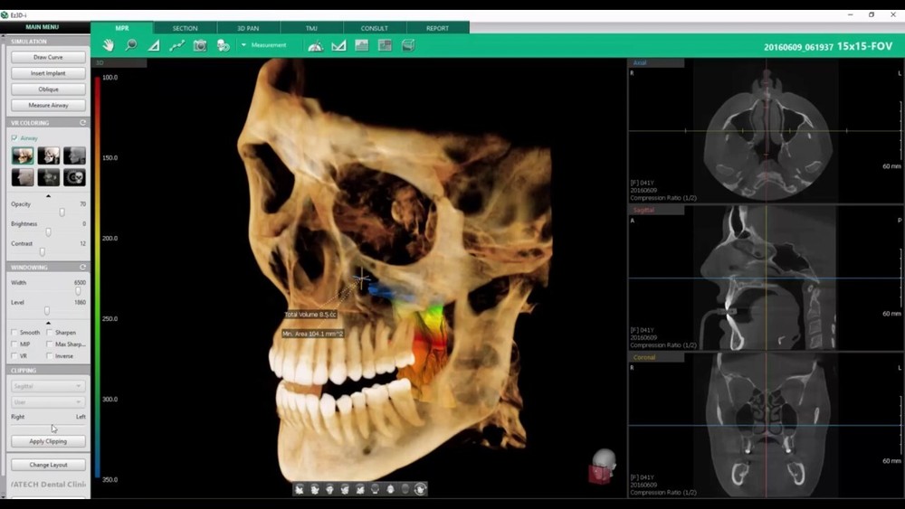 Vatech Ezdent-i & Ez3D-i Software w/ 10 license keys