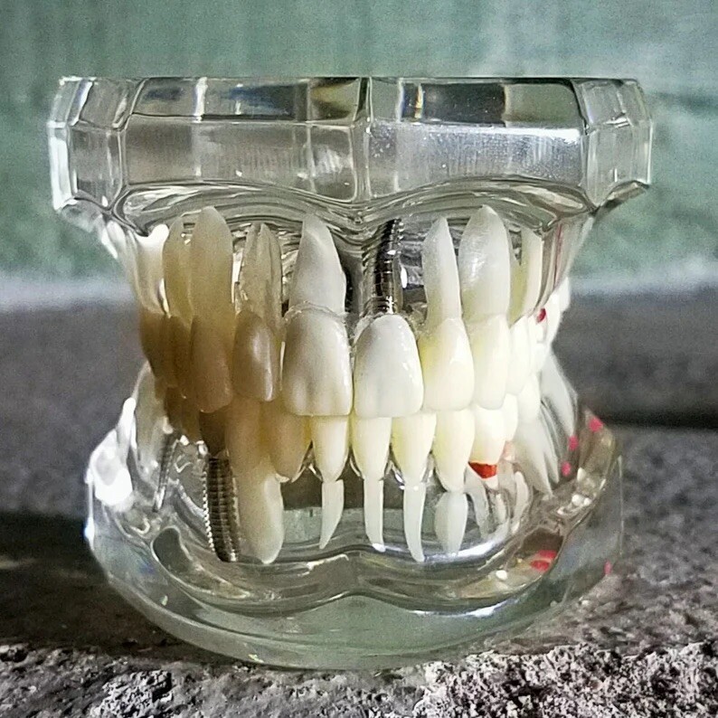 Dental Consultation Model