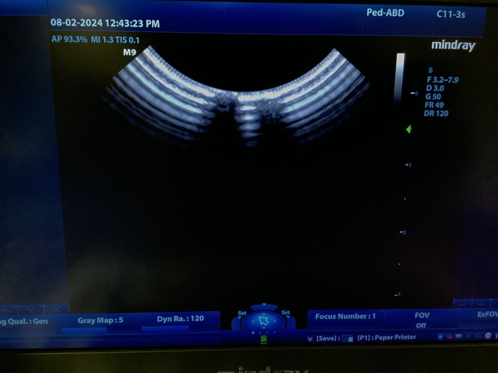 2023 Mindray C11-3s VET Convex Array Ultrasound Probe