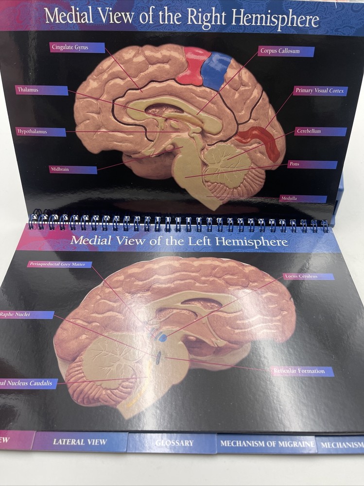 Maxalt Brain Anatomical Model Migraine Pathology Education Teaching Model