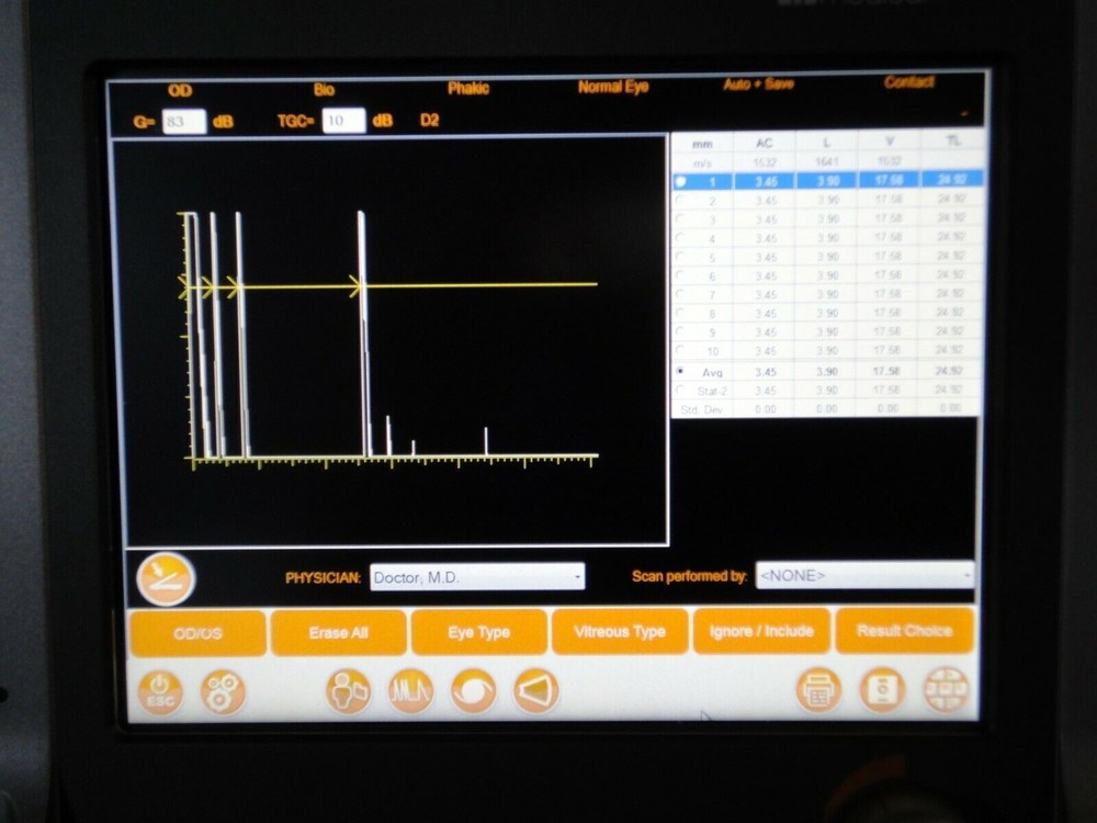 Quantel compact touch 2 touch scan A scan B scan ophthalmic ultrasound