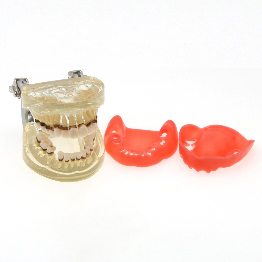 Dental Typodont Teeth Model Pathological Perio Implant Endo Caries Teeth Model