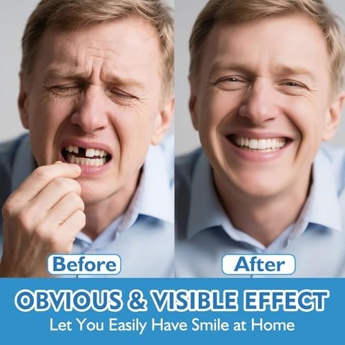 Moldable False Teeth Veneers - Silicone Dentures Set for Upper & Lower, DIY Smil
