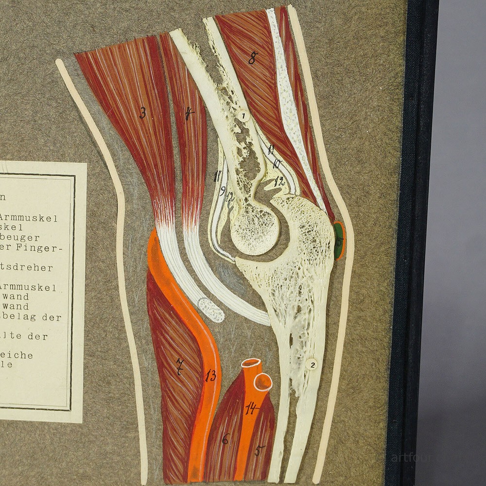 Antique Scientific Visual Aid - Bone Cut of the Human Elbow