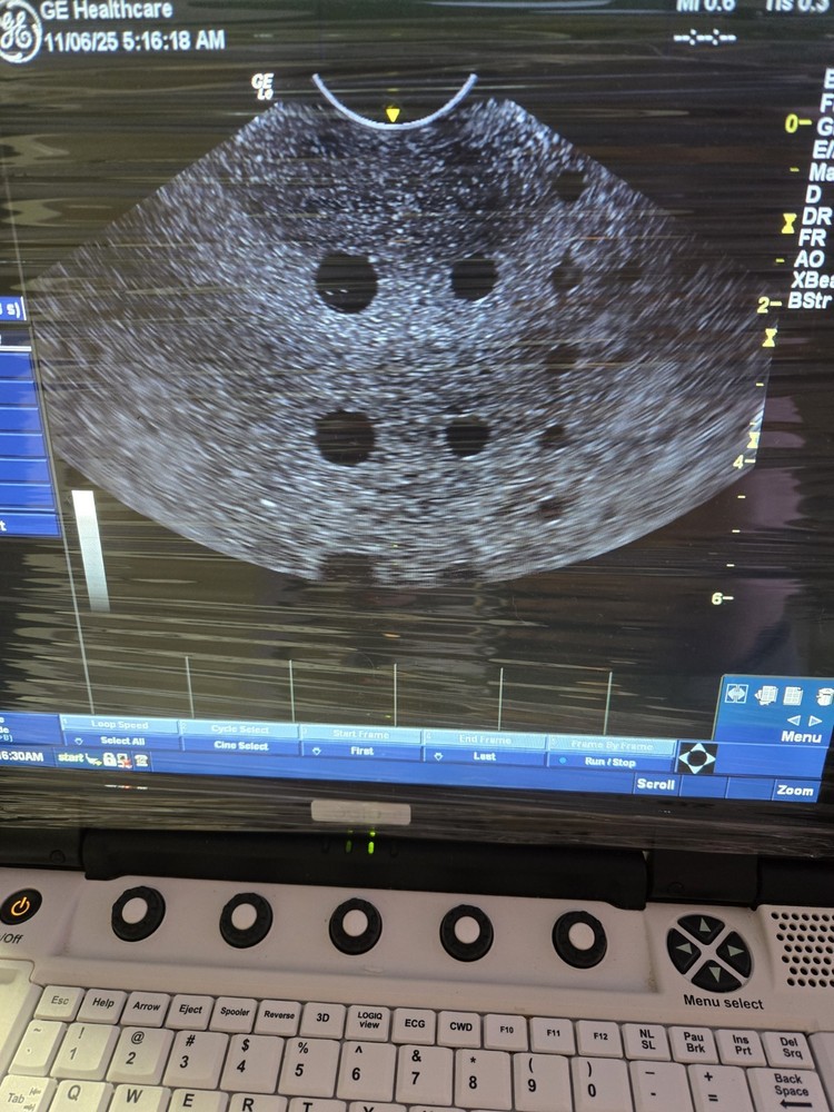 GE E8C-RS Ultrasound Probe / Transducer