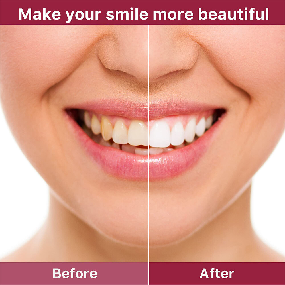 Sip-6 Toothpaste, Whitening Sp-6 Toothpaste, Deep Cleaning Brighten Toothpaste