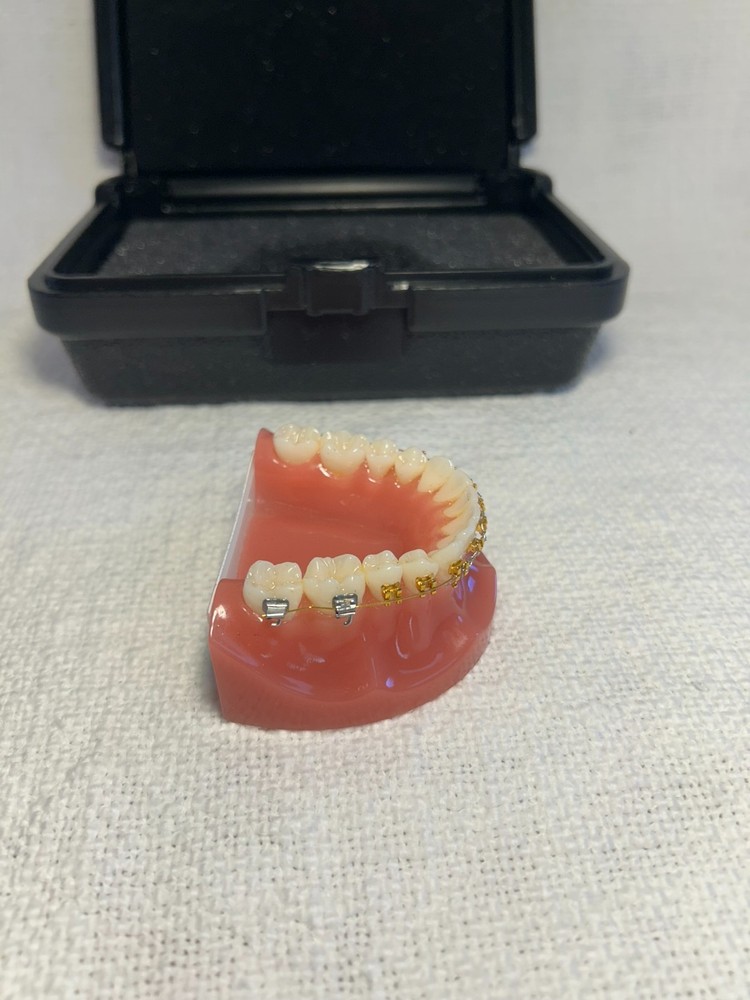 Orthodontic Study Model Dental Typodont - Gold & Silver Braces - Teaching Tool