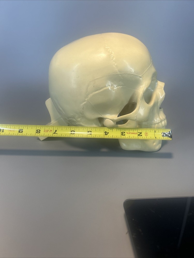Synbone, Human Skull, Surgical, Training, Education,
