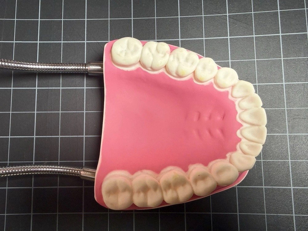 Oversized 6:1 Dental Teach Study Typodont Demonstration Teeth Model