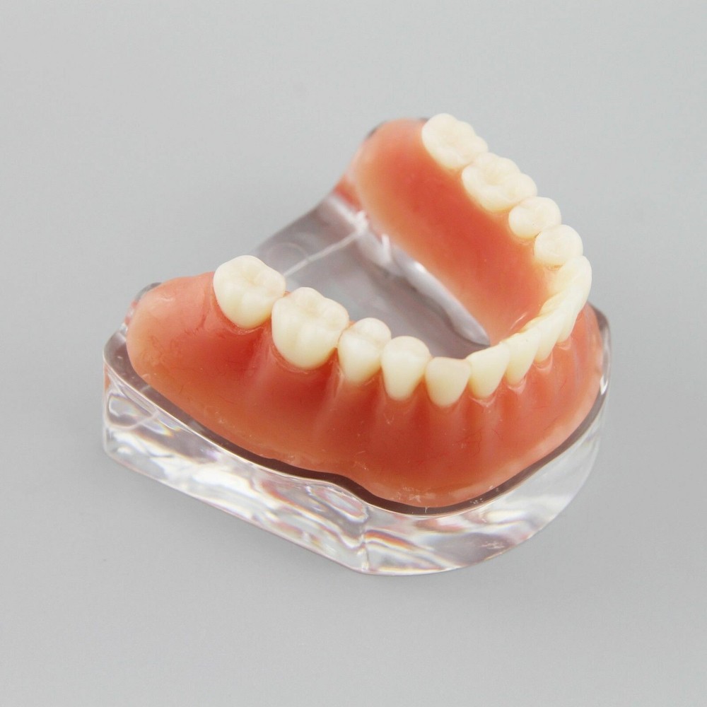 Dental Overdenture Study Demo Model Inferior M6008 Lower 4implants Silver Teeth