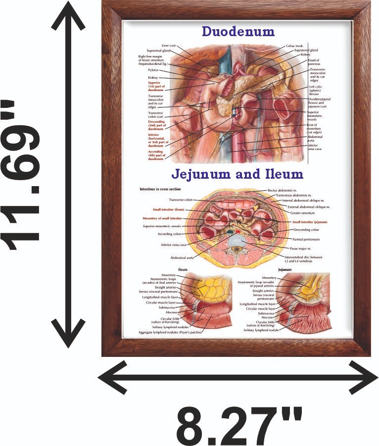 Duodenum Chart 12x18 inches