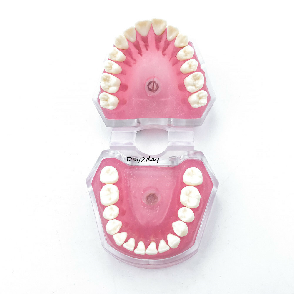 Teeth Model Dental Standard Model with Removable Teeth Dental Study Model