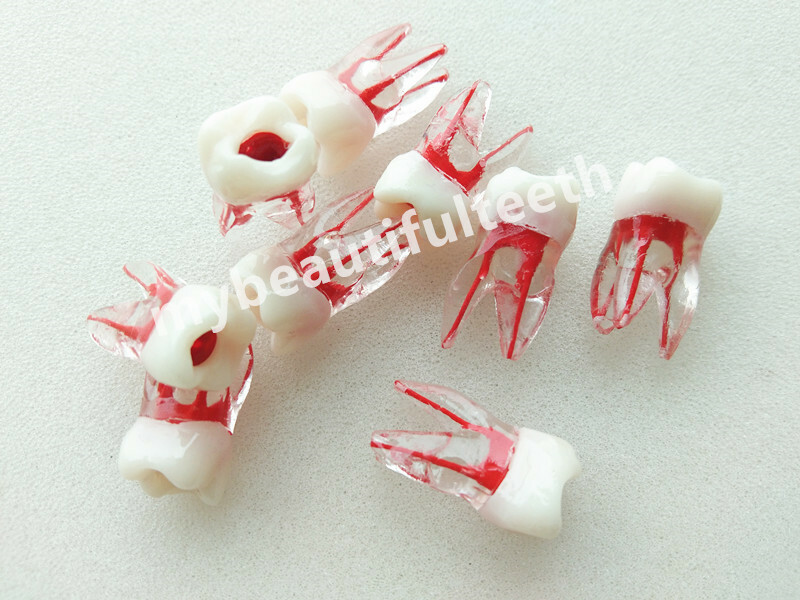 Dental Tooth Endo Root Canal Study Model RCT Practice Block Pulp Cavity