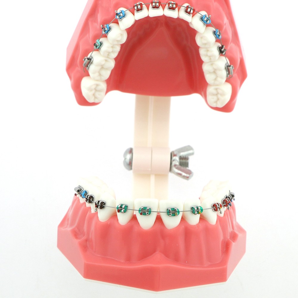US Dental Typodont Demonstration Teach Teeth Model with Braces For Patient Study