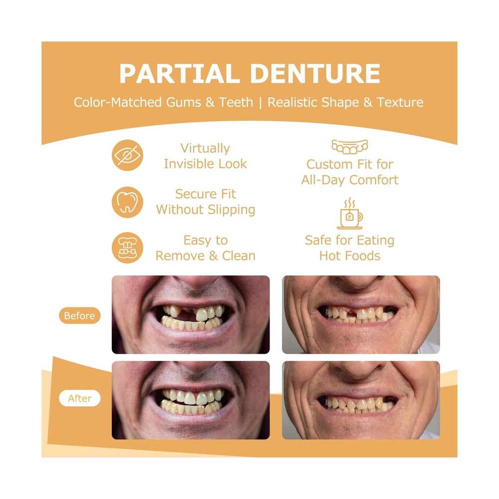 Partial Dentures - Dentures for Missing Teeth & Gaps - Lightweight & Unbreaka...
