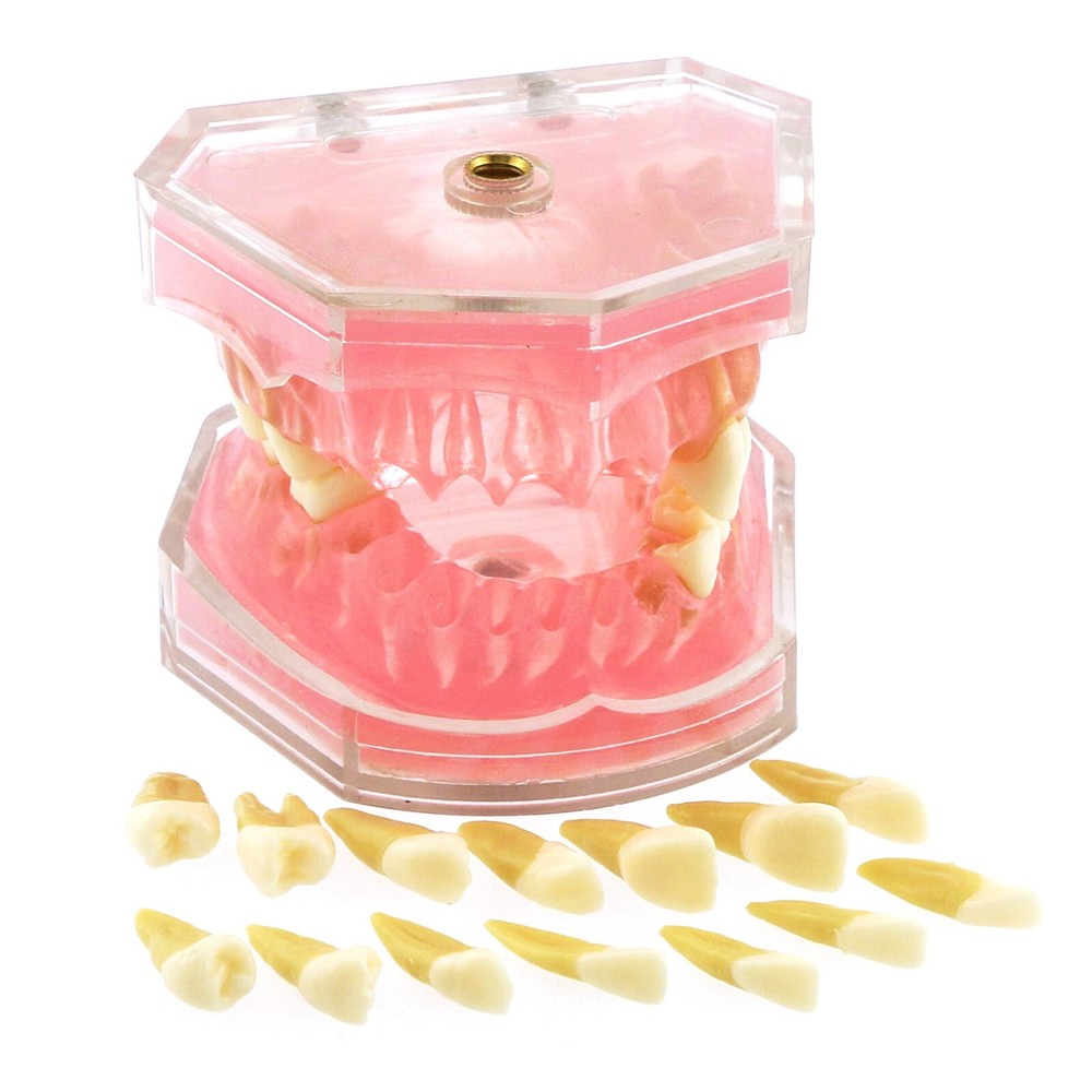 Dental Typodont Removable Soft Gum Teeth Model M7008 + Simulation Cheek