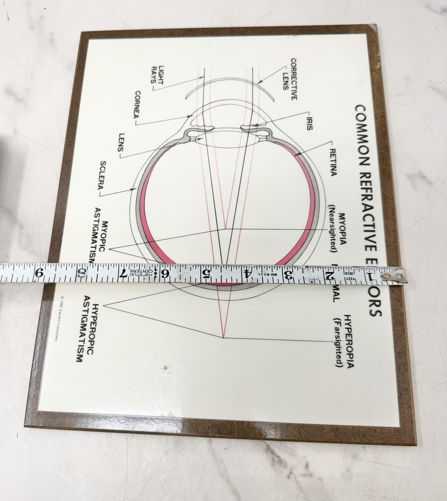 Vintage Optometry Eye Chart Board Common Refractive Errors Teaching Display
