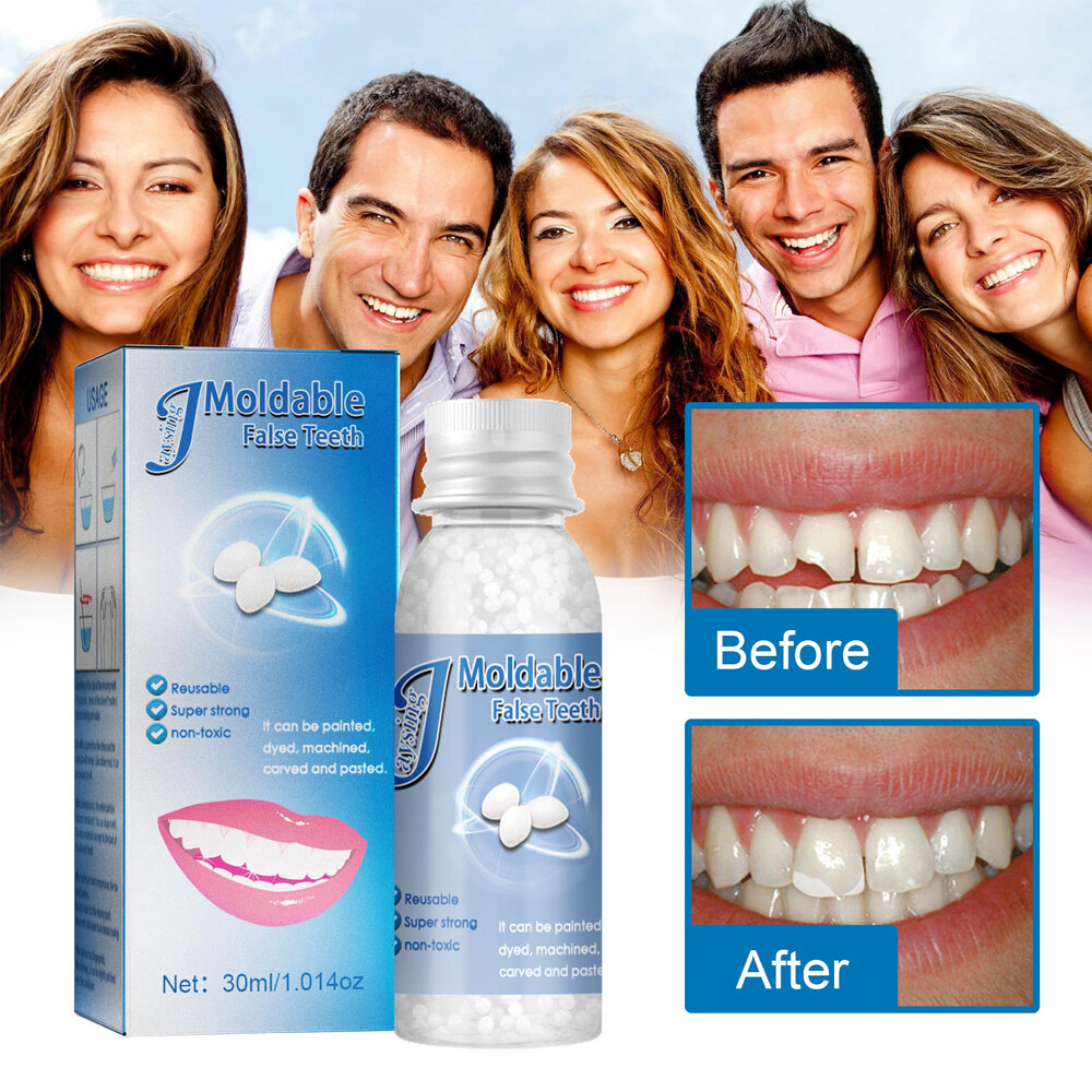 Resin False Teeth Solid Glue Temporary Tooth Repair Moldable Teeth Gap Denture