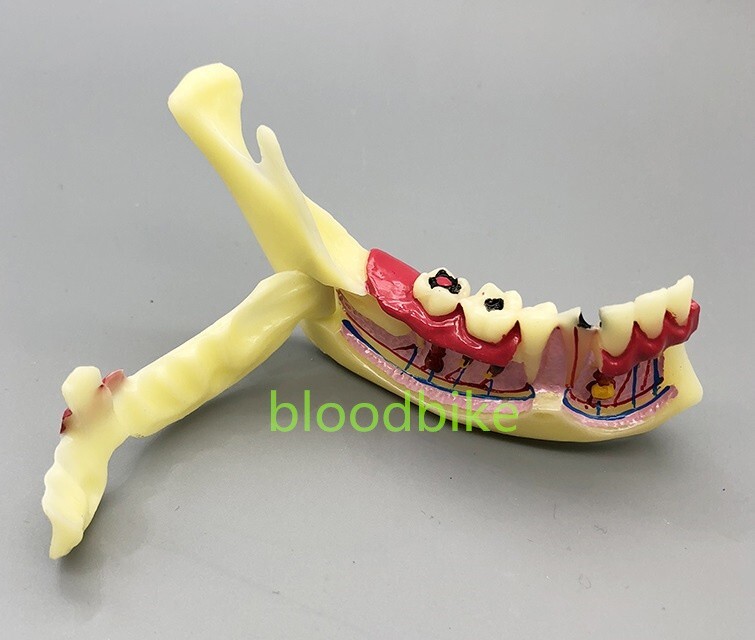 1pc Dental Typodont Teeth Study Teach Model Implant Endo Caries Demonstration