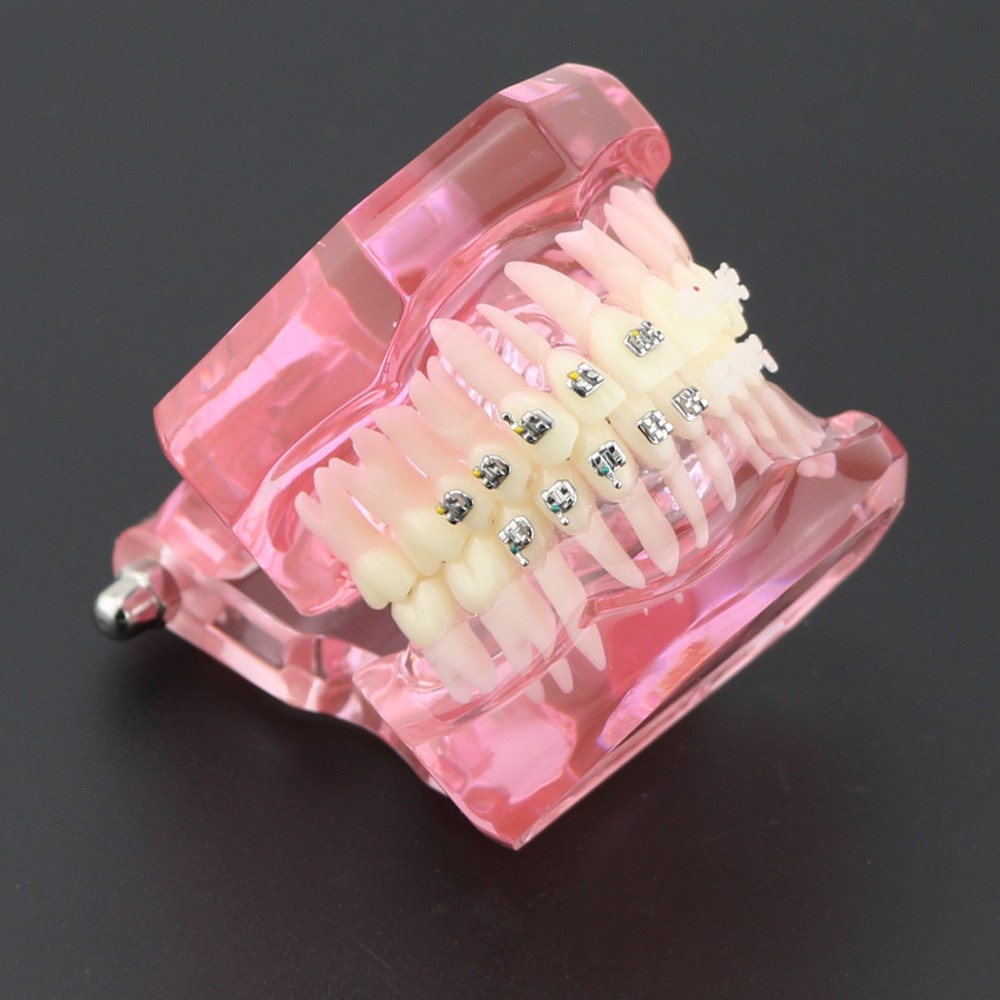 Dental Orthodontic Teeth Model Metal and Ceramic Bracket Study Teach Model 3003