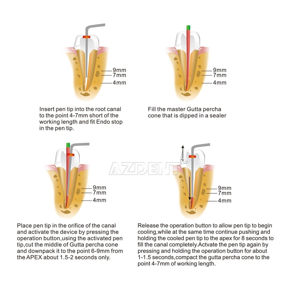 Dental Gutta Percha Obturation System Endodontic Endo Heated Pen +2 Heating Tips