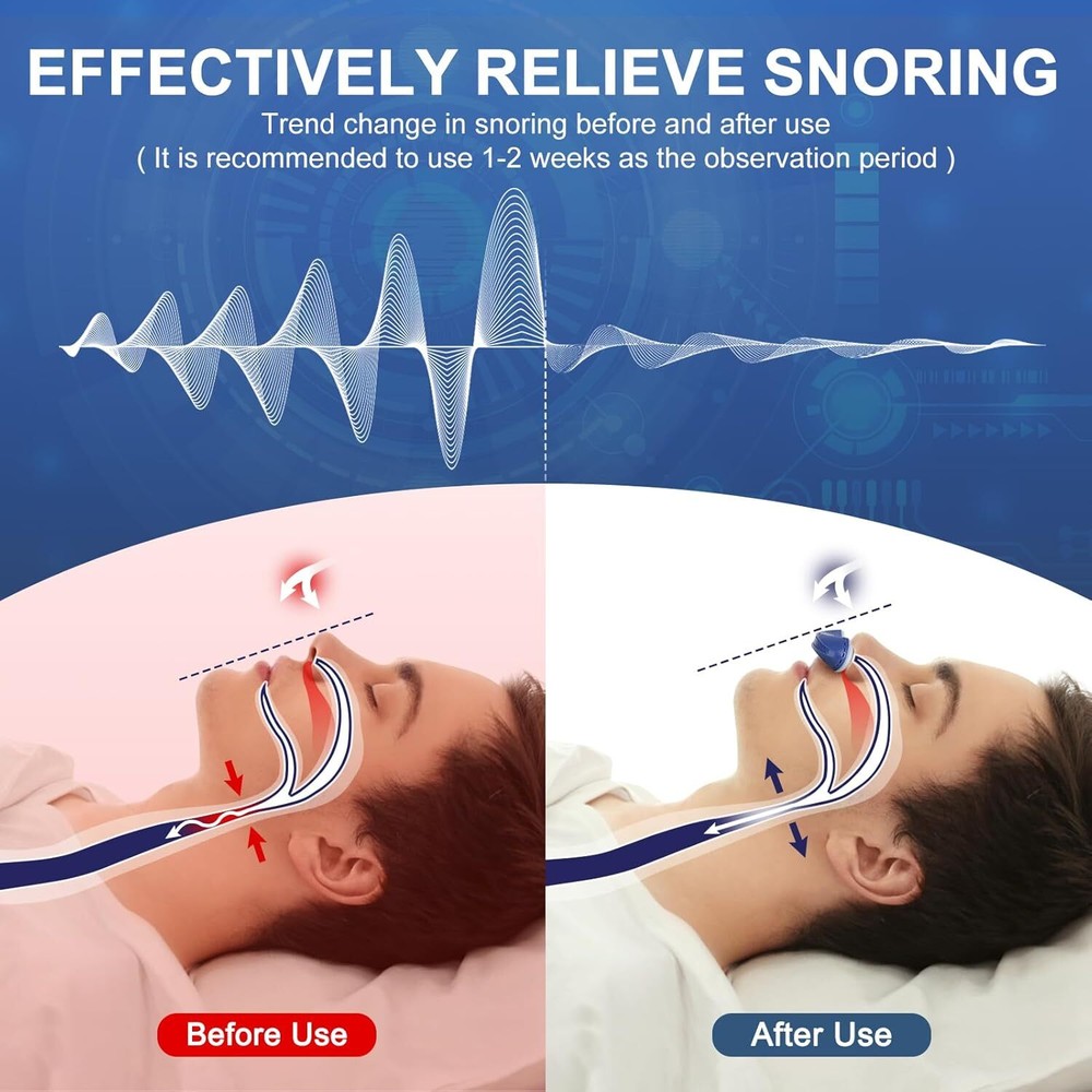 Portable Anti Snoring Device, Adjustable Wind Speed Snoring Solution Sleep Aid