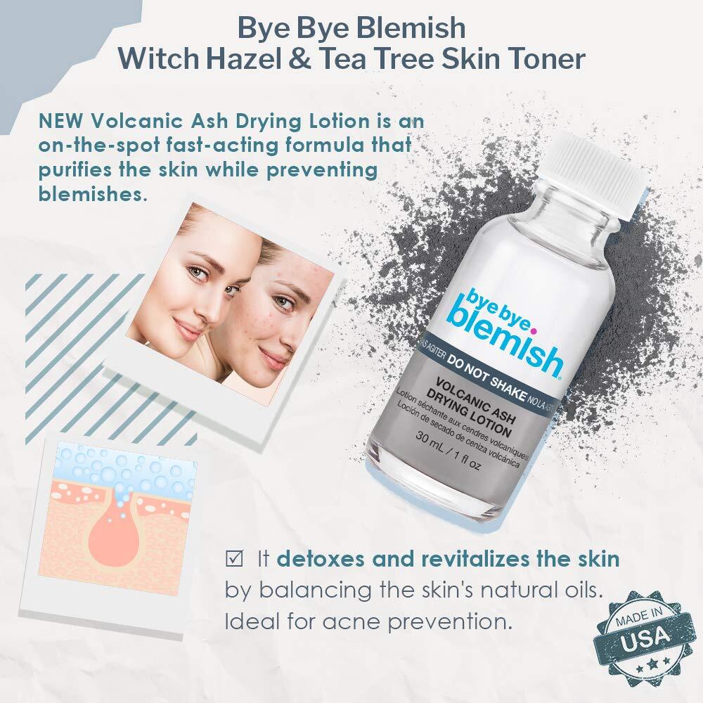 Bye Bye Blemish Drying Lotion Volcanic Ash Anti-Acne Drying Solution 1 Fl. Oz.