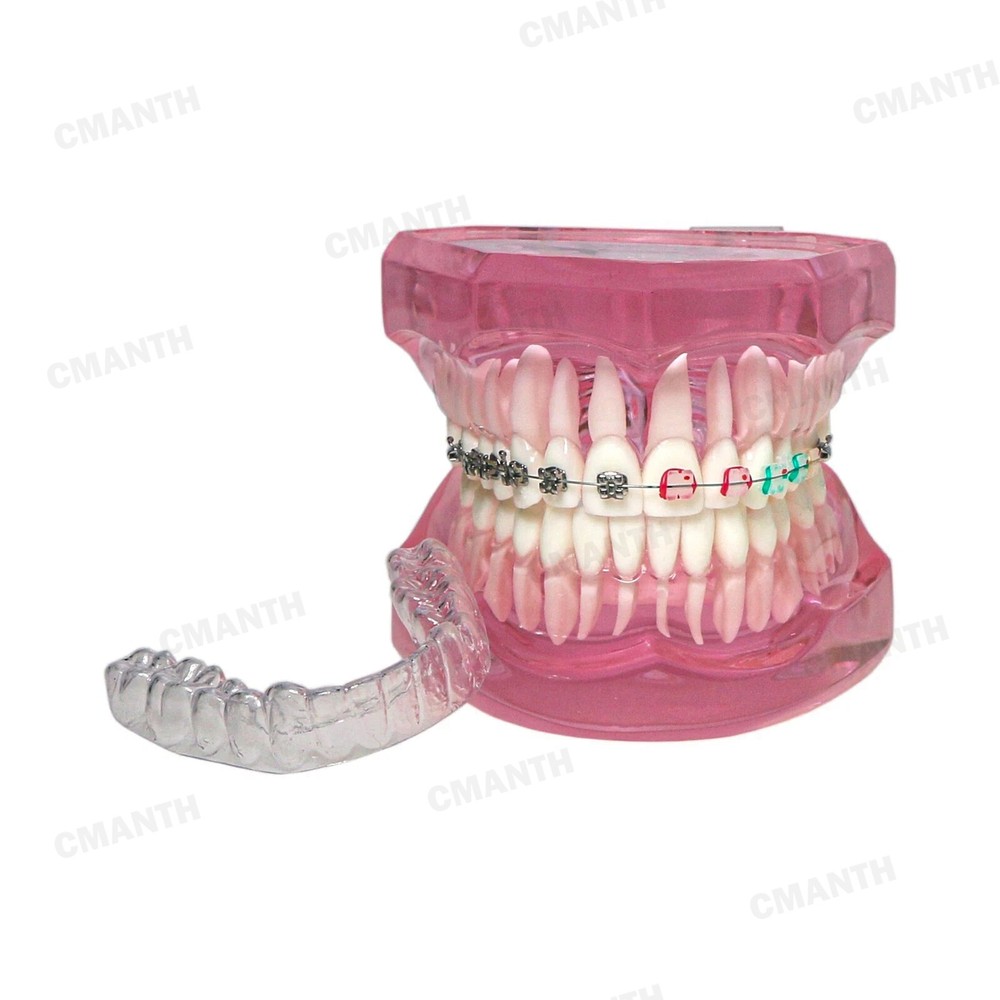 Dental 1:1 Teeth Model With Half Self ligating Metal Brackets Teaching Model